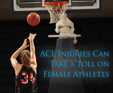 ACL Injuries Can Take a Toll on Female Athletes